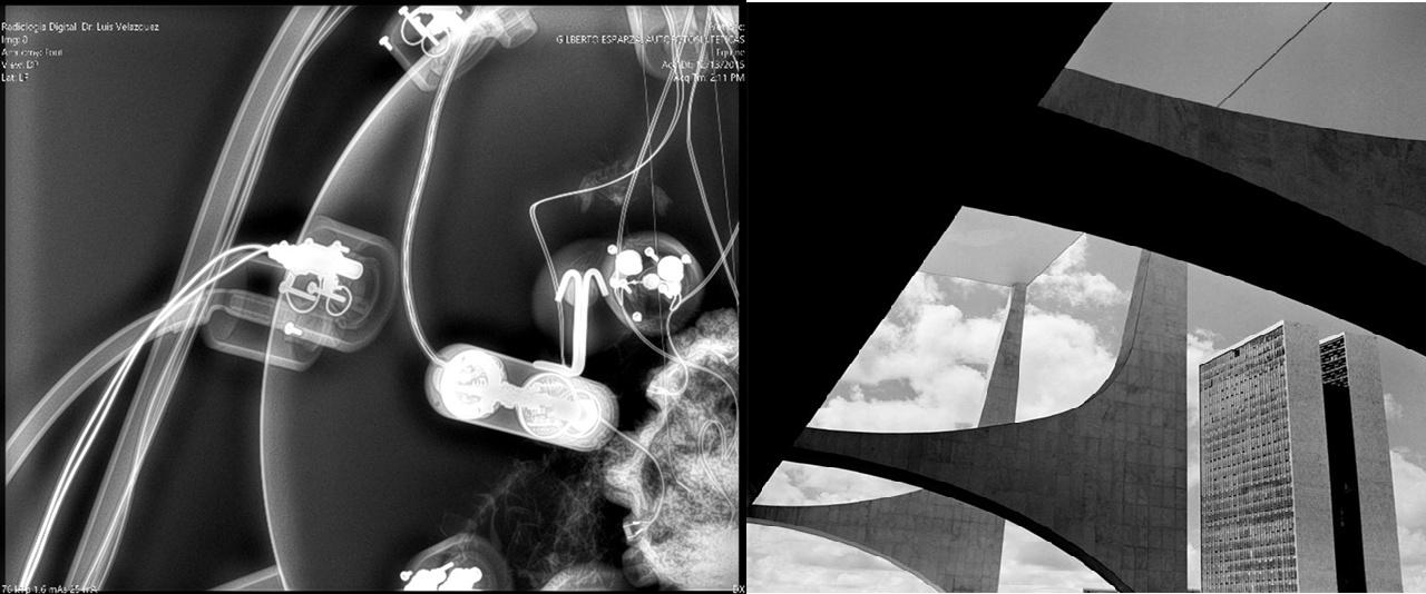 two photos side by side of an X-ray and an urban skyline